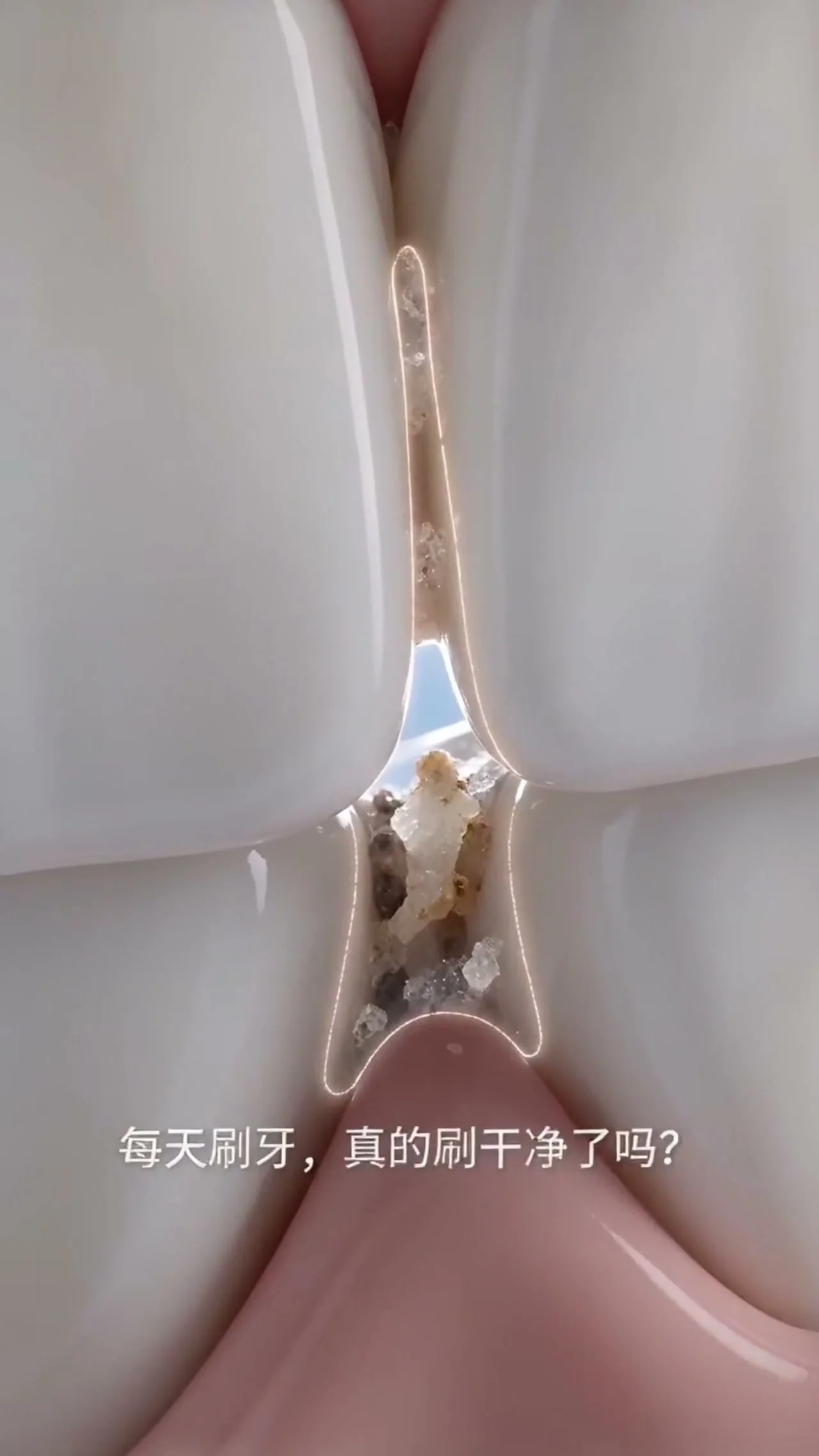 洁牙器 TVC